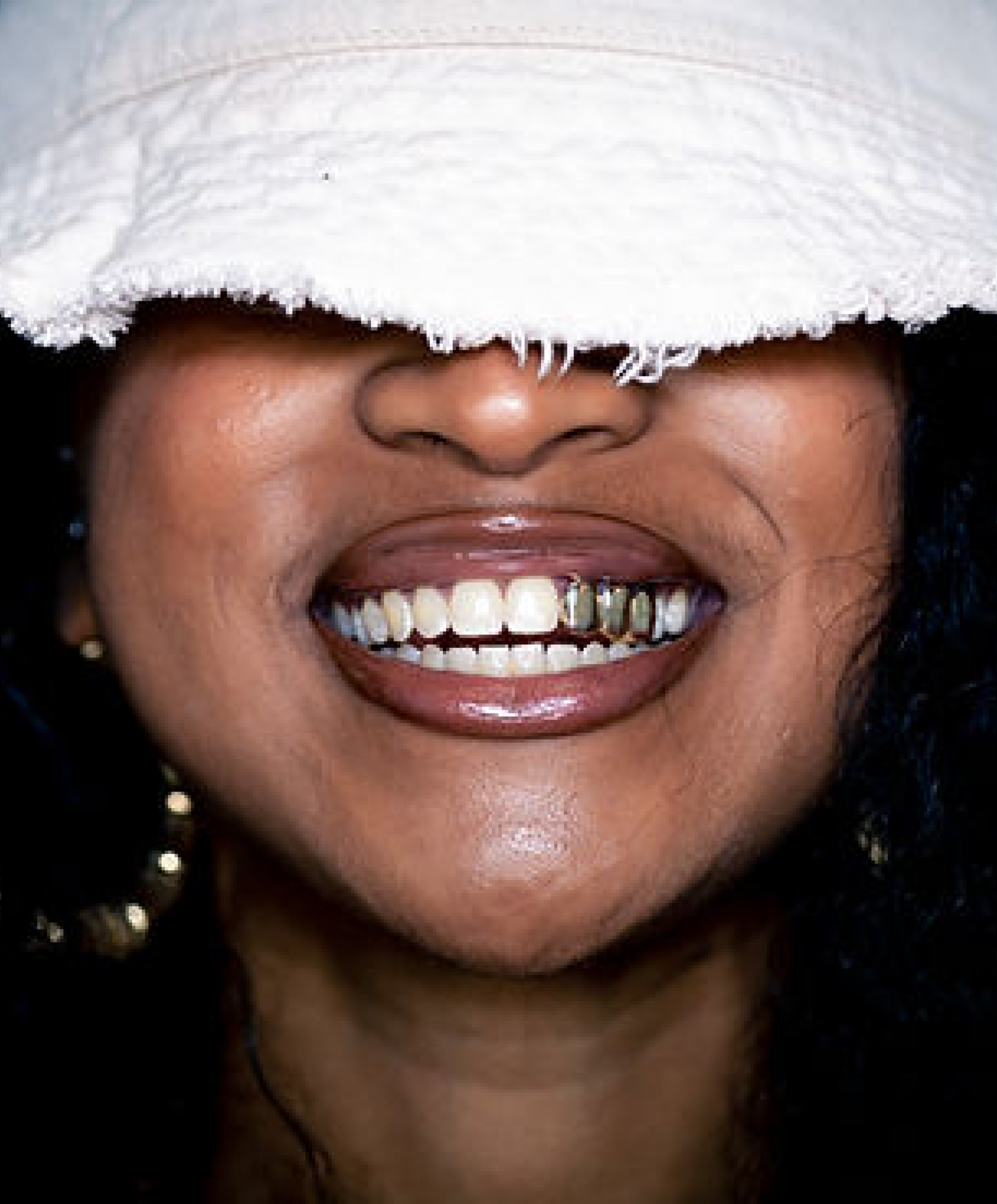 Woman showing 3 Gold teeth